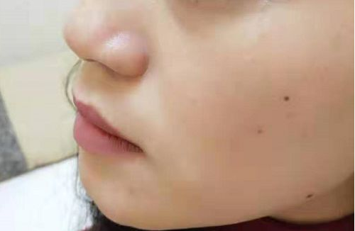 小氣泡美容儀器到底值不值的做呢！